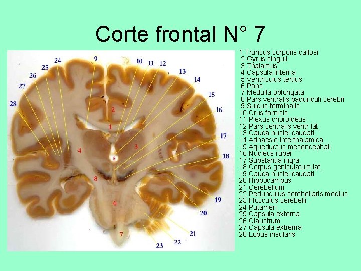 Corte frontal N° 7 • 1. Truncus corporis callosi 2. Gyrus cinguli 3. Thalamus
