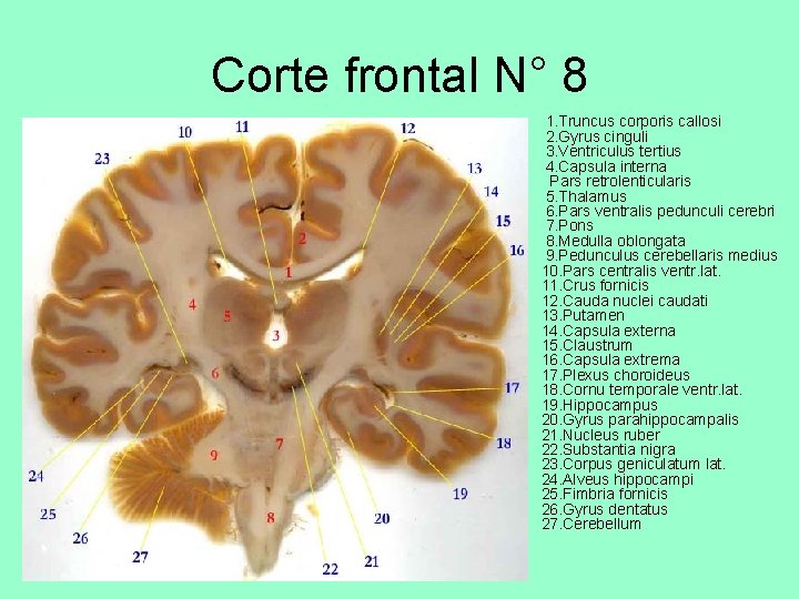 Corte frontal N° 8 • 1. Truncus corporis callosi 2. Gyrus cinguli 3. Ventriculus