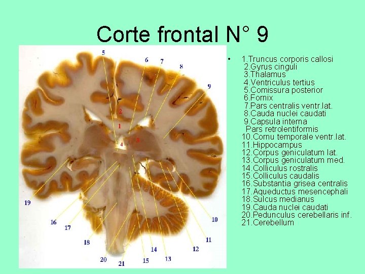 Corte frontal N° 9 • 1. Truncus corporis callosi 2. Gyrus cinguli 3. Thalamus