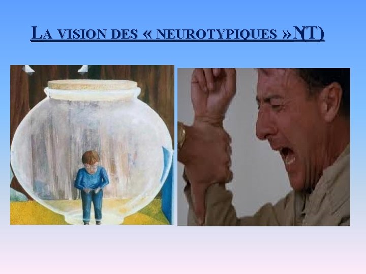 LA VISION DES « NEUROTYPIQUES » ( NT) 