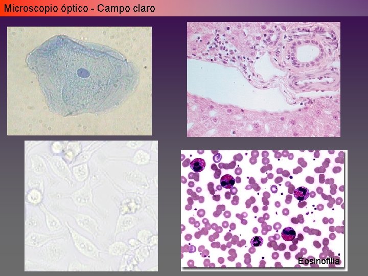Microscopio óptico - Campo claro Eosinofilia Microscopio óptico - Campo claro Eosinofilia