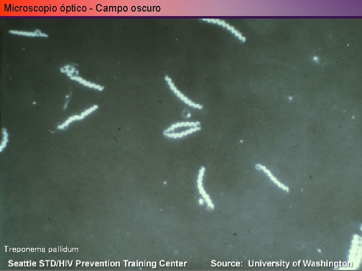 Microscopio óptico - Campo oscuro Treponema pallidum Microscopio óptico - Campo oscuro Treponema pallidum