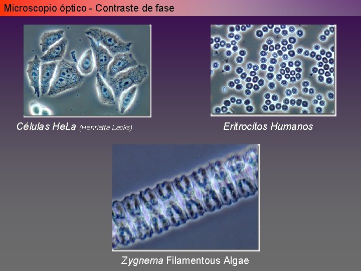 Microscopio óptico - Contraste de fase Células He. La (Henrietta Lacks) Eritrocitos Humanos Zygnema Microscopio óptico - Contraste de fase Células He. La (Henrietta Lacks) Eritrocitos Humanos Zygnema