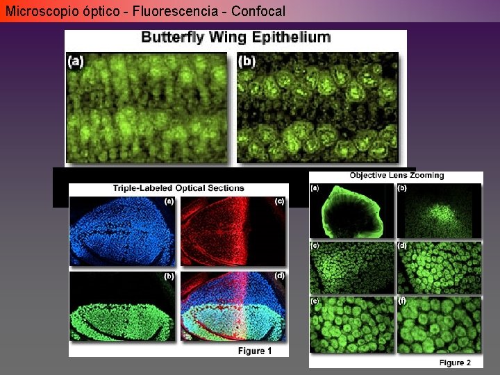 Microscopio óptico - Fluorescencia - Confocal Microscopio óptico - Fluorescencia - Confocal