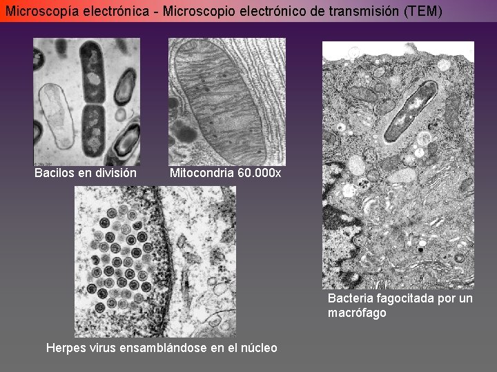 Microscopía electrónica - Microscopio electrónico de transmisión (TEM) Bacilos en división Mitocondria 60. 000 Microscopía electrónica - Microscopio electrónico de transmisión (TEM) Bacilos en división Mitocondria 60. 000