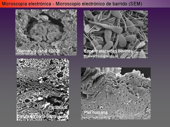 Microscopía electrónica - Microscopio electrónico de barrido (SEM) Glomérulo renal 1200 x Célula en Microscopía electrónica - Microscopio electrónico de barrido (SEM) Glomérulo renal 1200 x Célula en