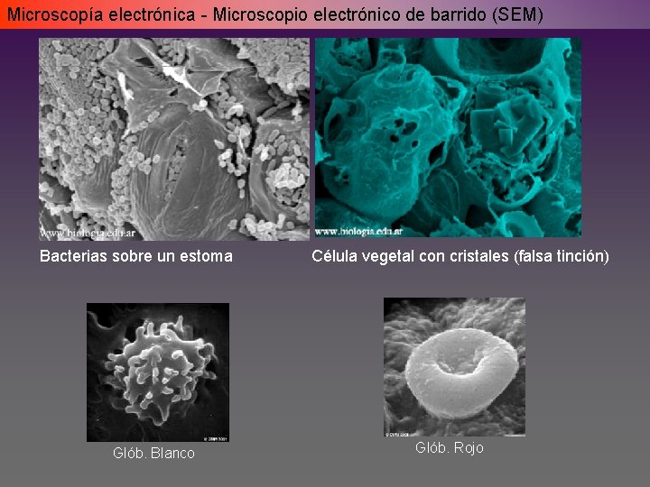 Microscopía electrónica - Microscopio electrónico de barrido (SEM) Bacterias sobre un estoma Glób. Blanco Microscopía electrónica - Microscopio electrónico de barrido (SEM) Bacterias sobre un estoma Glób. Blanco