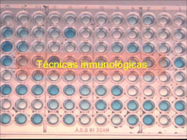 Técnicas inmunológicas Técnicas inmunológicas