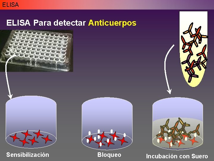ELISA Para detectar Anticuerpos Sensibilización Bloqueo Incubación con Suero ELISA Para detectar Anticuerpos Sensibilización Bloqueo Incubación con Suero