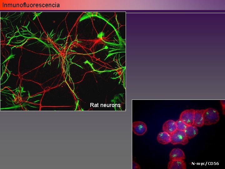 Inmunofluorescencia Rat neurons N-myc/CD 56 Inmunofluorescencia Rat neurons N-myc/CD 56