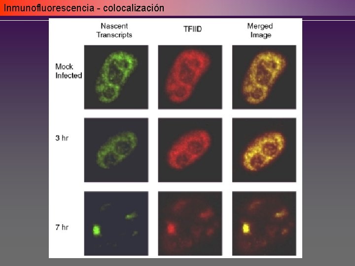 Inmunofluorescencia - colocalización Inmunofluorescencia - colocalización