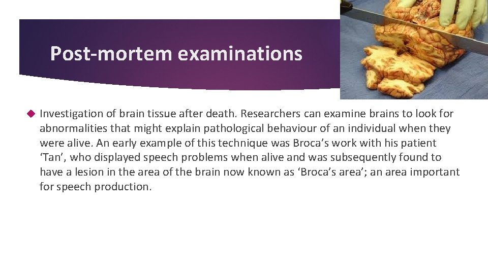 Post-mortem examinations Investigation of brain tissue after death. Researchers can examine brains to look