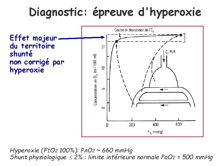 Diagnostic: épreuve d'hyperoxie Effet majeur du territoire shunté non corrigé par hyperoxie Hyperoxie (FIO