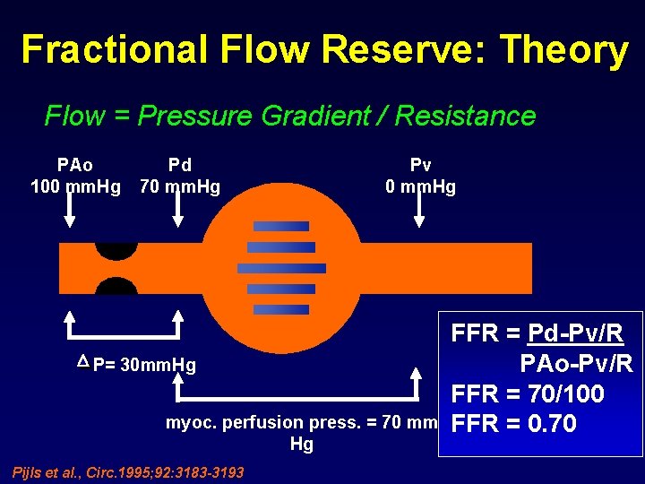 Fractional Flow Reserve: Theory Flow = Pressure Gradient / Resistance PAo 100 mm. Hg