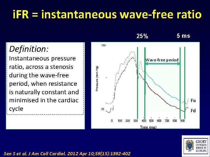 i. FR = instantaneous wave-free ratio 25% 5 ms Definition: Instantaneous pressure ratio, across