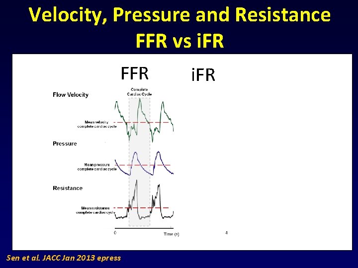 Velocity, Pressure and Resistance FFR vs i. FR FFR i. FR HIGHER FLOW BIGGER