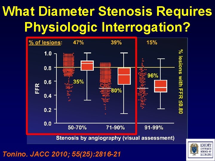 What Diameter Stenosis Requires Physiologic Interrogation? Tonino. JACC 2010; 55(25): 2816 -21 