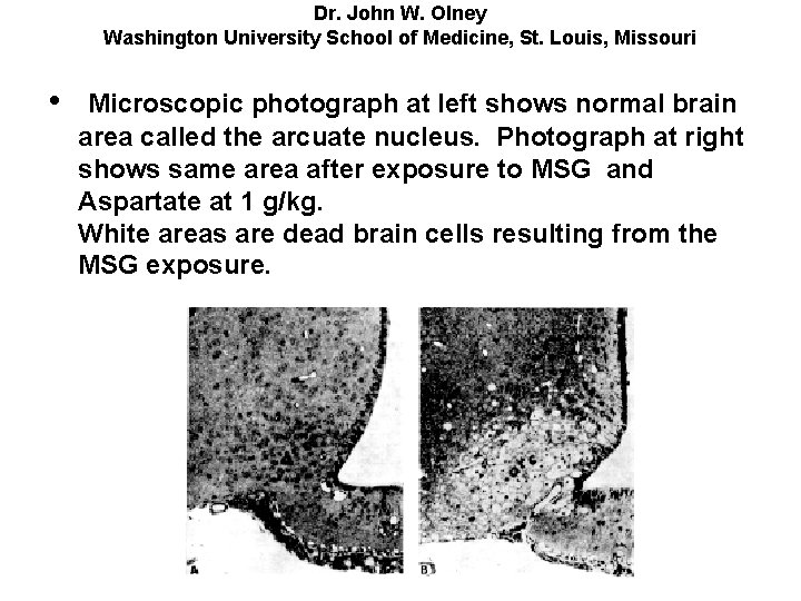 Dr. John W. Olney Washington University School of Medicine, St. Louis, Missouri • Microscopic