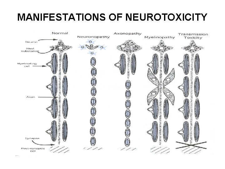 MANIFESTATIONS OF NEUROTOXICITY 