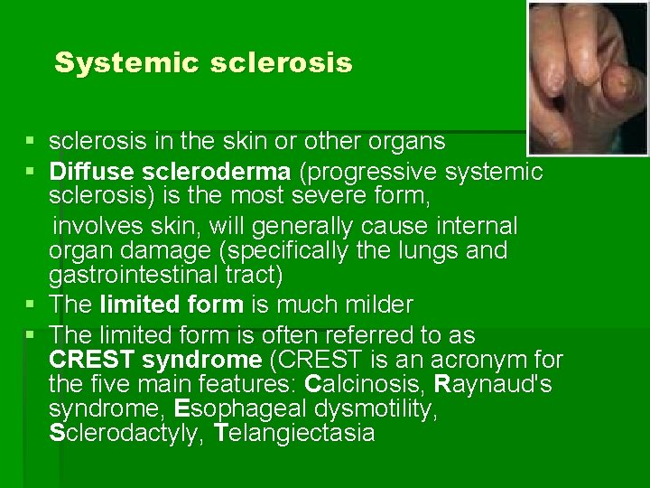 Systemic sclerosis § sclerosis in the skin or other organs § Diffuse scleroderma (progressive