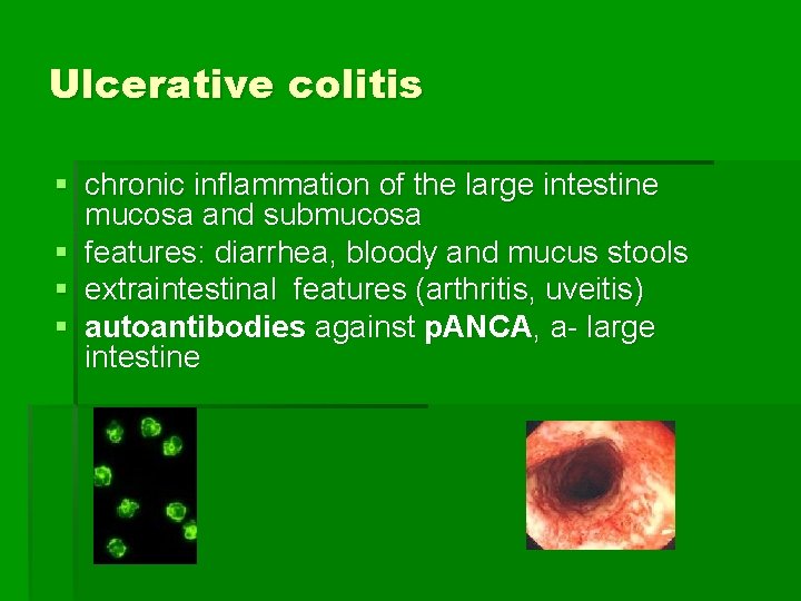 Ulcerative colitis § chronic inflammation of the large intestine mucosa and submucosa § features: