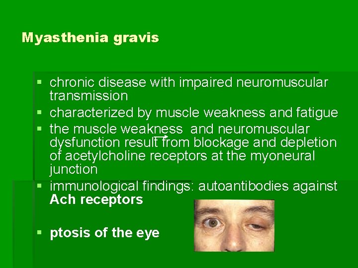 Myasthenia gravis § chronic disease with impaired neuromuscular transmission § characterized by muscle weakness