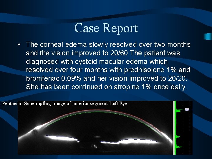 Case Report • The corneal edema slowly resolved over two months and the vision
