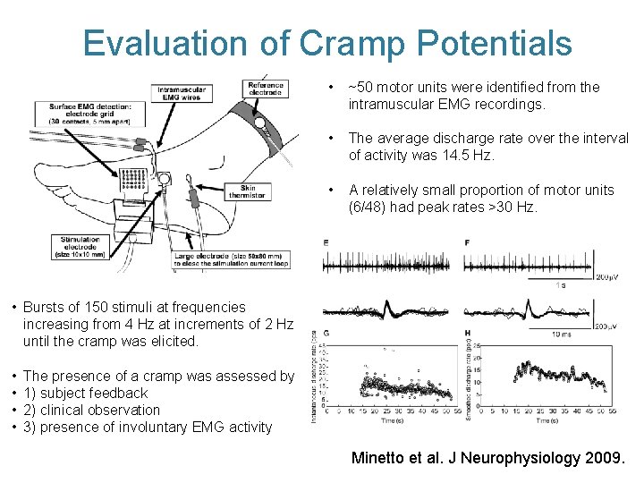 Evaluation of Cramp Potentials • ~50 motor units were identified from the intramuscular EMG