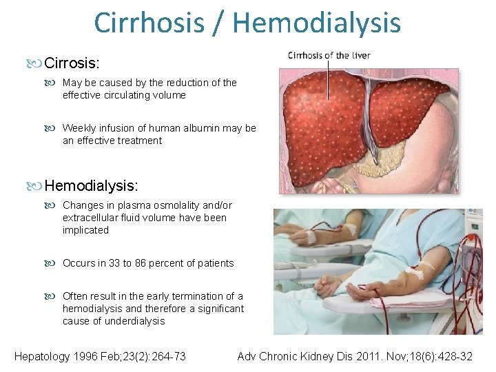 Cirrhosis / Hemodialysis Cirrosis: May be caused by the reduction of the effective circulating