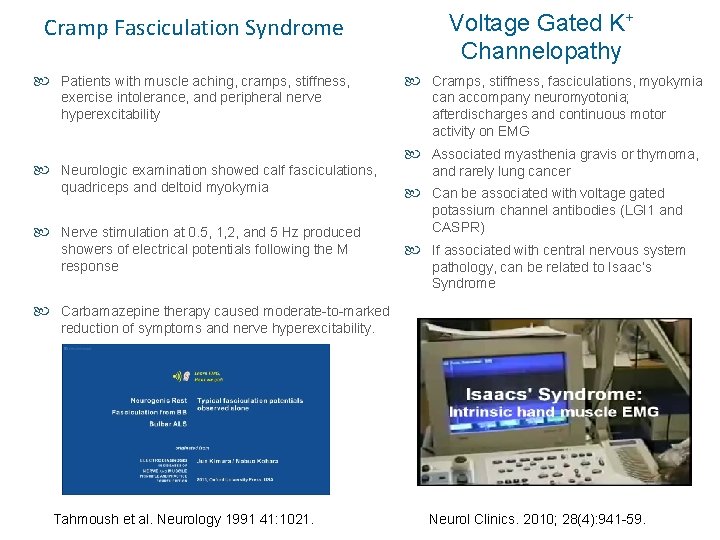 Cramp Fasciculation Syndrome Patients with muscle aching, cramps, stiffness, exercise intolerance, and peripheral nerve