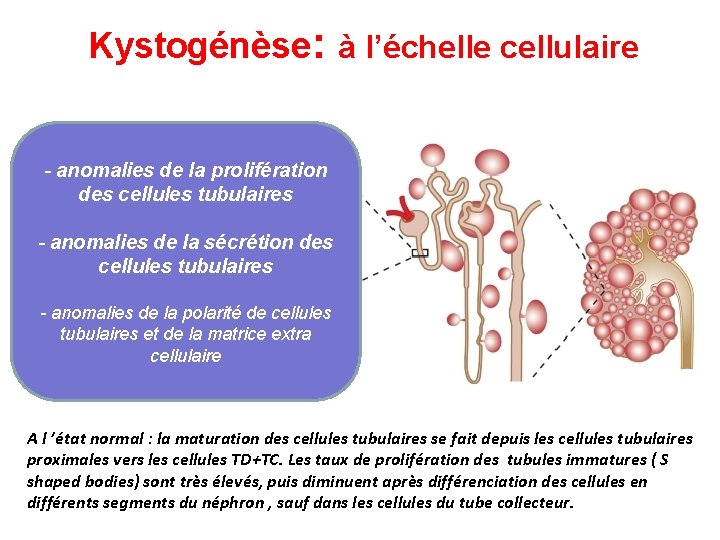 Kystogénèse: à l’échelle cellulaire - anomalies de la prolifération des cellules tubulaires - anomalies