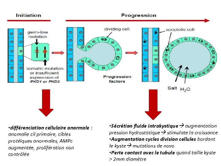  • différenciation cellulaire anormale : anomalie cil primaire, cibles protéiques anormales, AMPc augmentée,