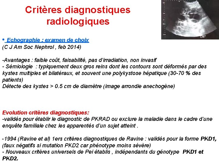 Critères diagnostiques radiologiques • Echographie : examen de choix (C J Am Soc Nephrol