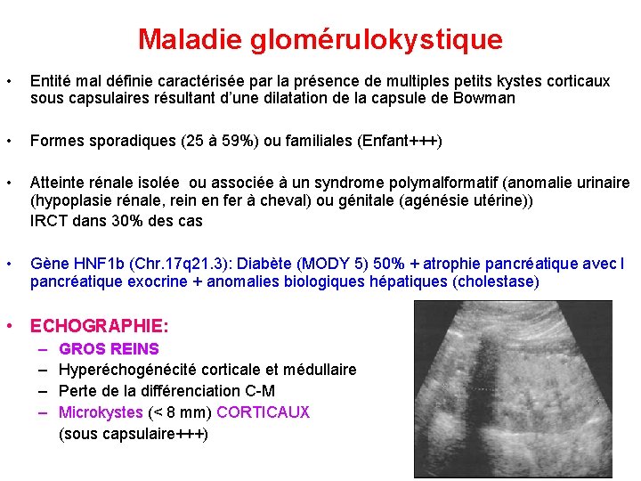 Maladie glomérulokystique • Entité mal définie caractérisée par la présence de multiples petits kystes