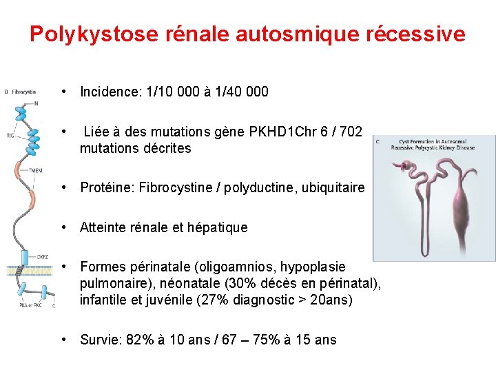 Polykystose rénale autosmique récessive • Incidence: 1/10 000 à 1/40 000 • Liée à