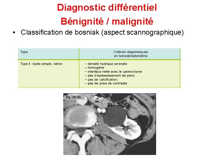 Diagnostic différentiel Bénignité / malignité • Classification de bosniak (aspect scannographique) 
