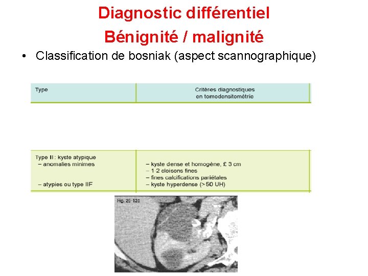 Diagnostic différentiel Bénignité / malignité • Classification de bosniak (aspect scannographique) 