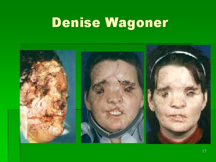Denise Wagoner 17 