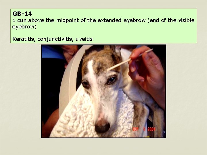 GB-14 1 cun above the midpoint of the extended eyebrow (end of the visible