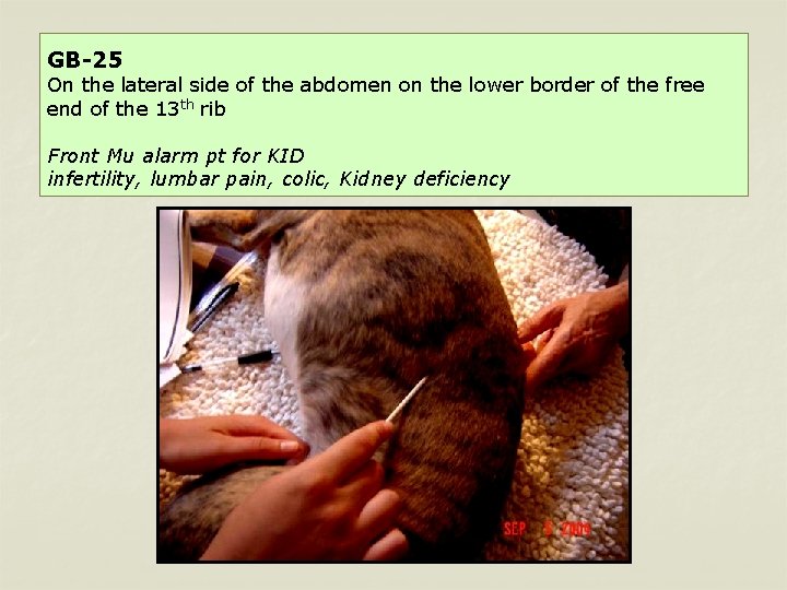 GB-25 On the lateral side of the abdomen on the lower border of the