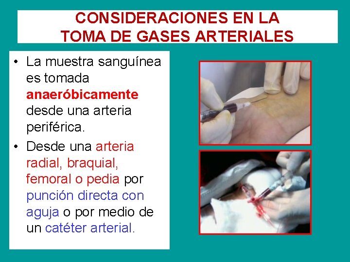 CONSIDERACIONES EN LA TOMA DE GASES ARTERIALES • La muestra sanguínea es tomada anaeróbicamente