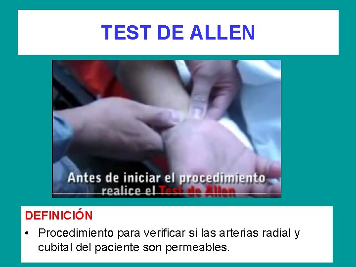 TEST DE ALLEN DEFINICIÓN • Procedimiento para verificar si las arterias radial y cubital
