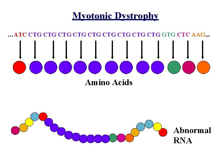 Myotonic Dystrophy …ATC CTG CTG CTG GTG CTC AAG. . . Amino Acids Abnormal