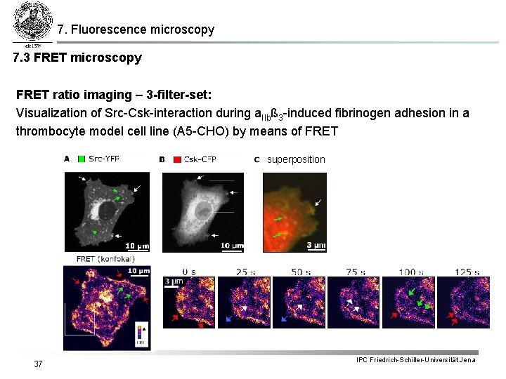 7. Fluorescence microscopy 7. 3 FRET microscopy FRET ratio imaging – 3 -filter-set: Visualization