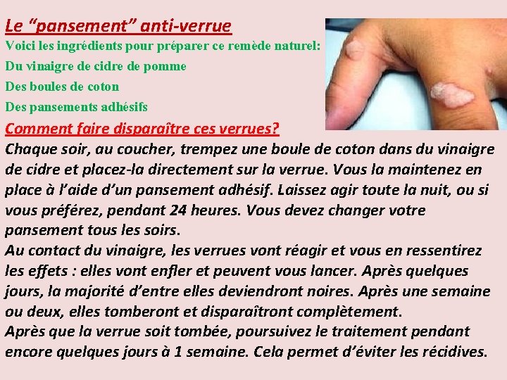 Le “pansement” anti-verrue Voici les ingrédients pour préparer ce remède naturel: Du vinaigre de