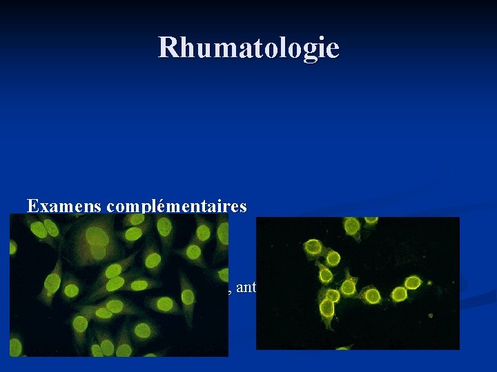 Rhumatologie Examens complémentaires Laboratoire n Bilan Auto-immunité n Anticorps antinucléaires, anti tissus, anti-thyroïdiens, anti.