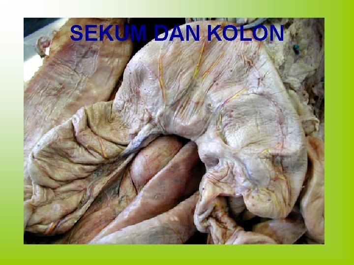 SEKUM DAN KOLON 