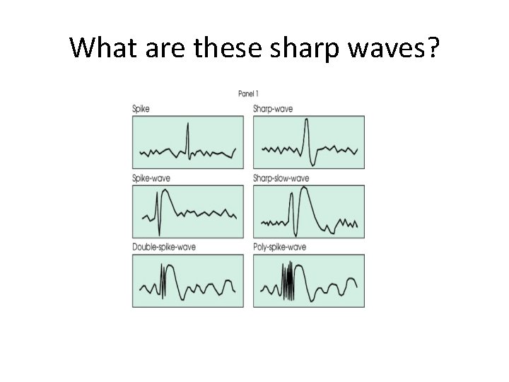 What are these sharp waves? 