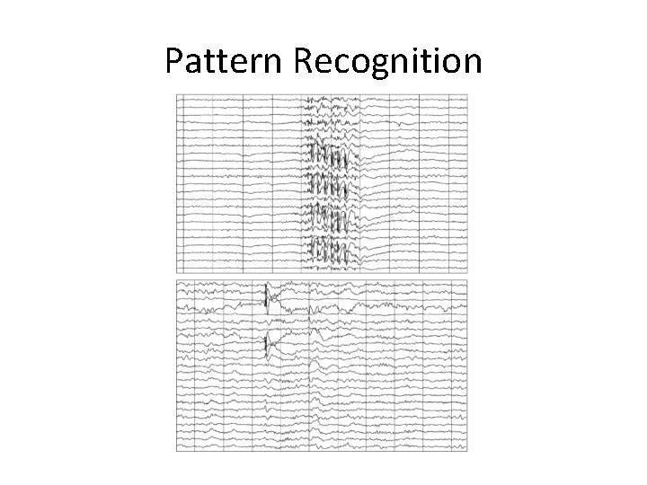Pattern Recognition 