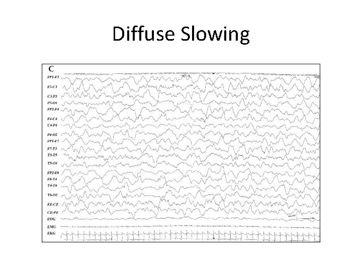 Diffuse Slowing 